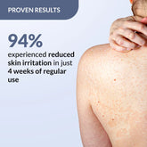 Salyzap Spray for Body Acne